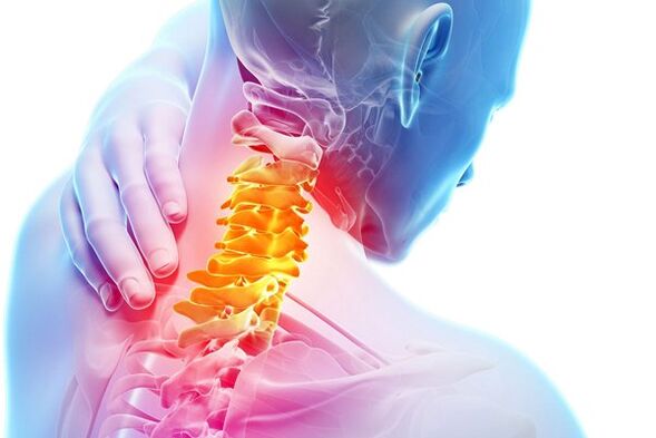 Osteokonondrosaren cervikalaren arrazoiak