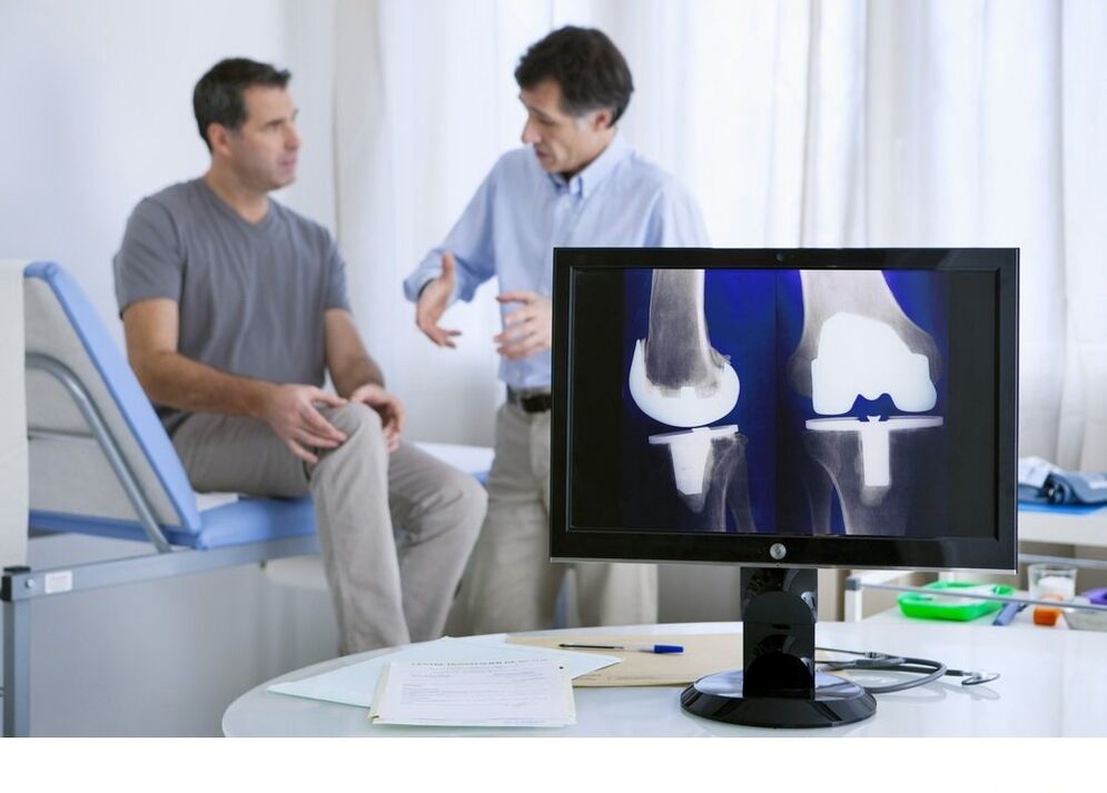 Belauneko artikulazioaren artrosia X -Ray irudian